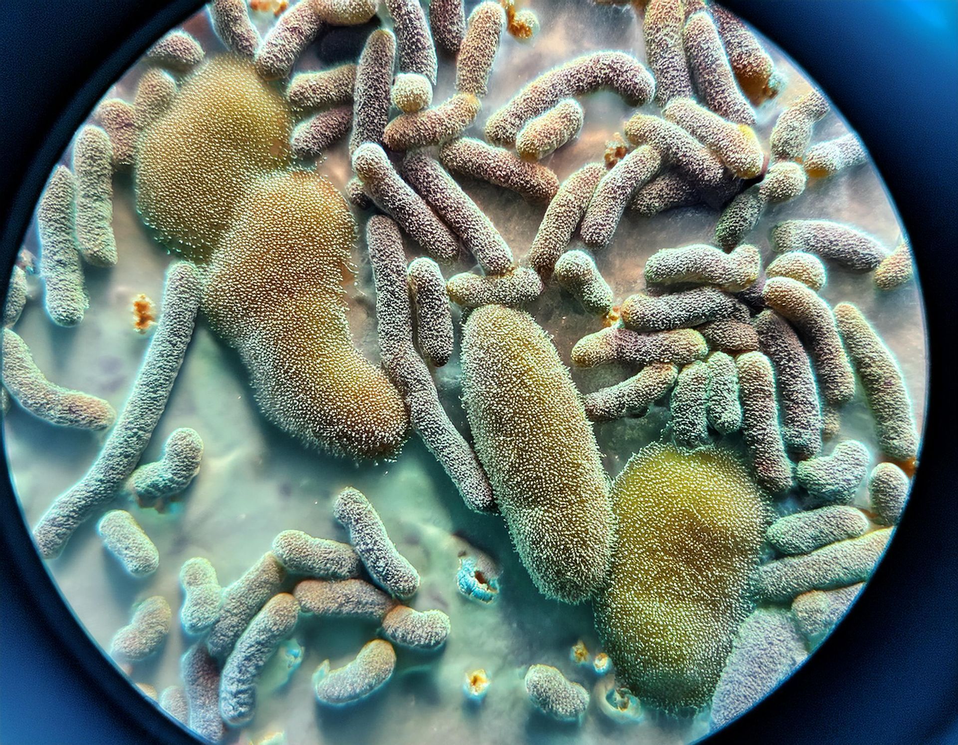 Fagoterapia para combatir las superbacterias