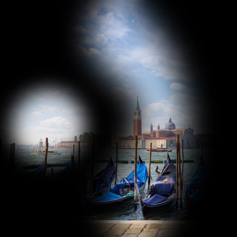 Glaukom Schäden durch ein Glaukom