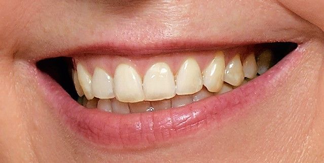 Prophylaxe Behandlung bei Praxis Dr. Kadir Aksogan, R