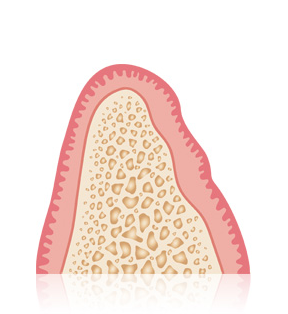 Ablauf Implantat und Qualität bei Praxis Dr. Kadir Aksogan, R