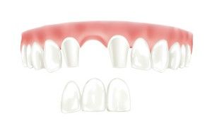 Keramik Brücke, Dr. Kadir Aksogan