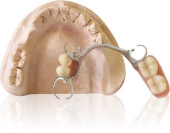 Modelguss Prothese, Labor Dr. Kadir Aksogan