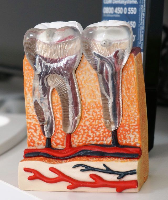 Leistungen Wurzel Kanal Beh., Praxis Dr. Kadir Aksogan, R