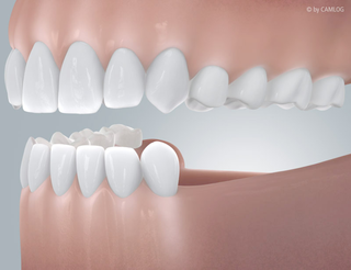 Implantat und Qualität bei Praxis Dr. Kadir Aksogan, R