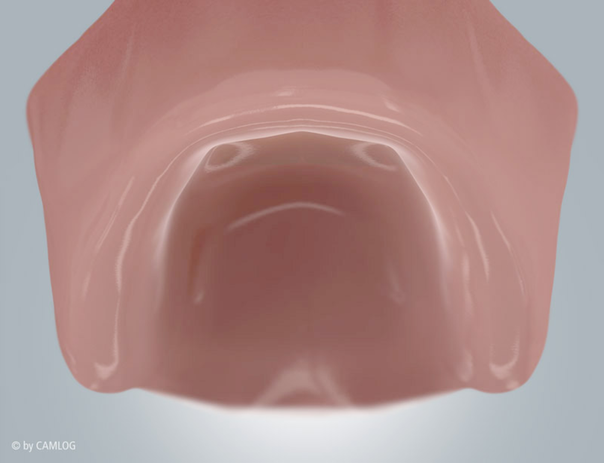 Implantat und Qualität bei Praxis Dr. Kadir Aksogan, R