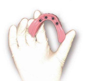 Mini Implantat und Qualität bei Praxis Dr. Kadir Aksogan, R