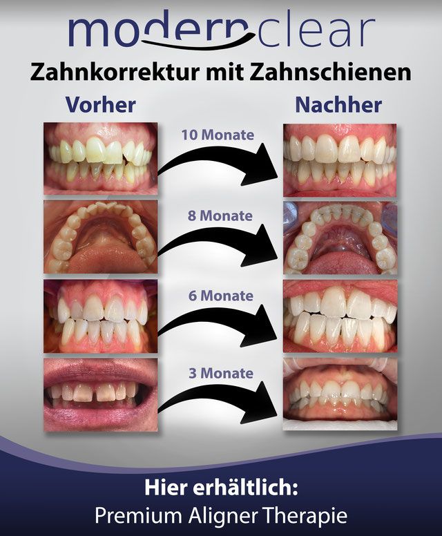 Ästhetik Behandlung, bei Praxis Dr. Kadir Aksogan, R