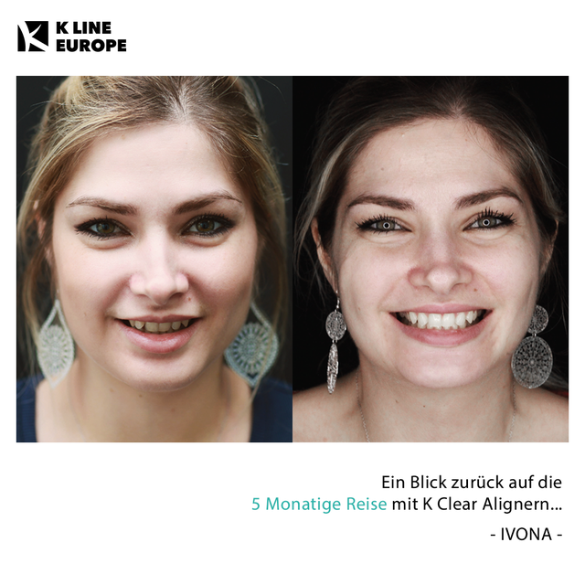 Ästhetik Behandlung, bei Praxis Dr. Kadir Aksogan, R