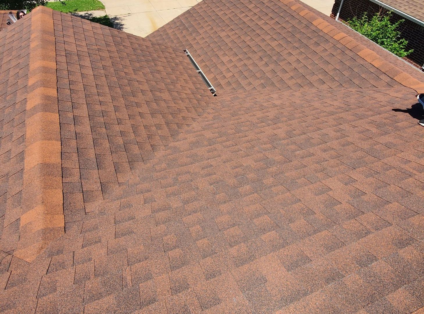 Shingles