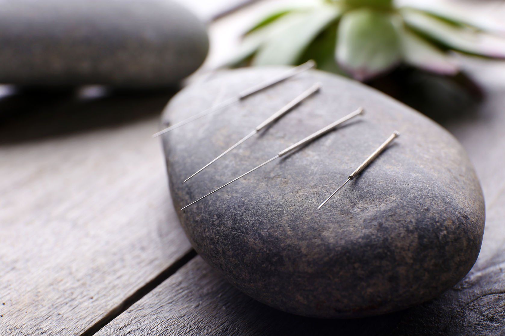Acupuncture