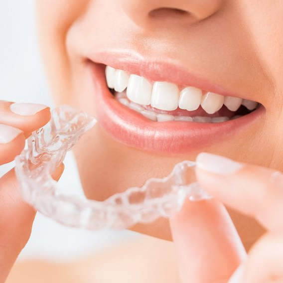Unsichtbare Zahnschienen sind beliebt, auch bei unseren Patienten der Kieferorthopädie aus Neuss und Umgebung.