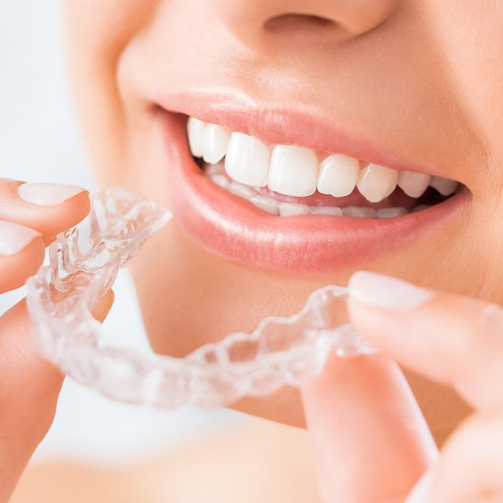 Unsichtbare Zahnspange (Invisalign®) Unsichtbare Zahnschienen sind beliebt, auch bei unseren Patienten der Kieferorthopädie aus Neuss und Umgebung.