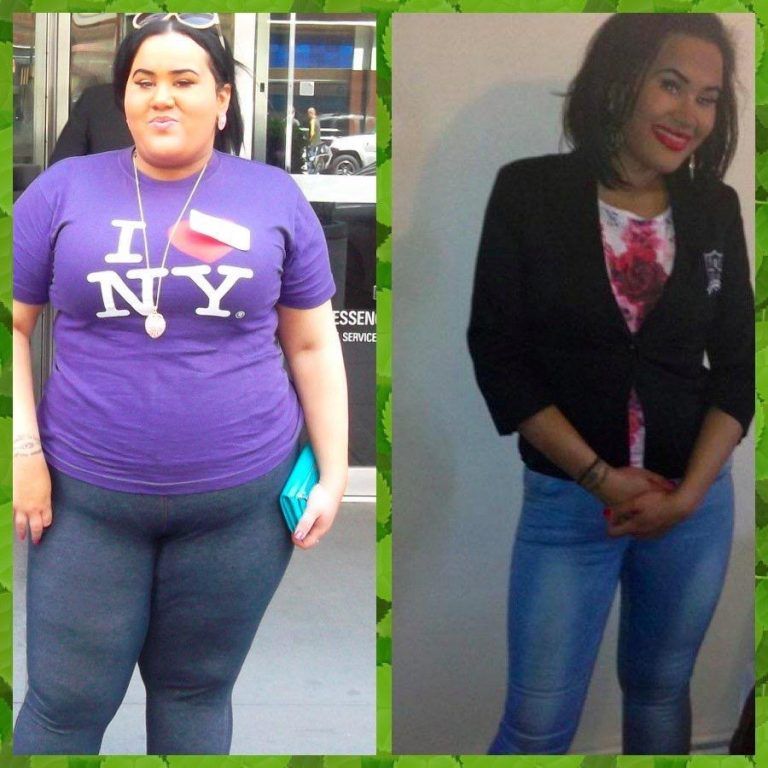 Jessie Sharp Biggest Lose Weight Loss Before and After