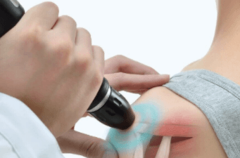 Shockwave therapy