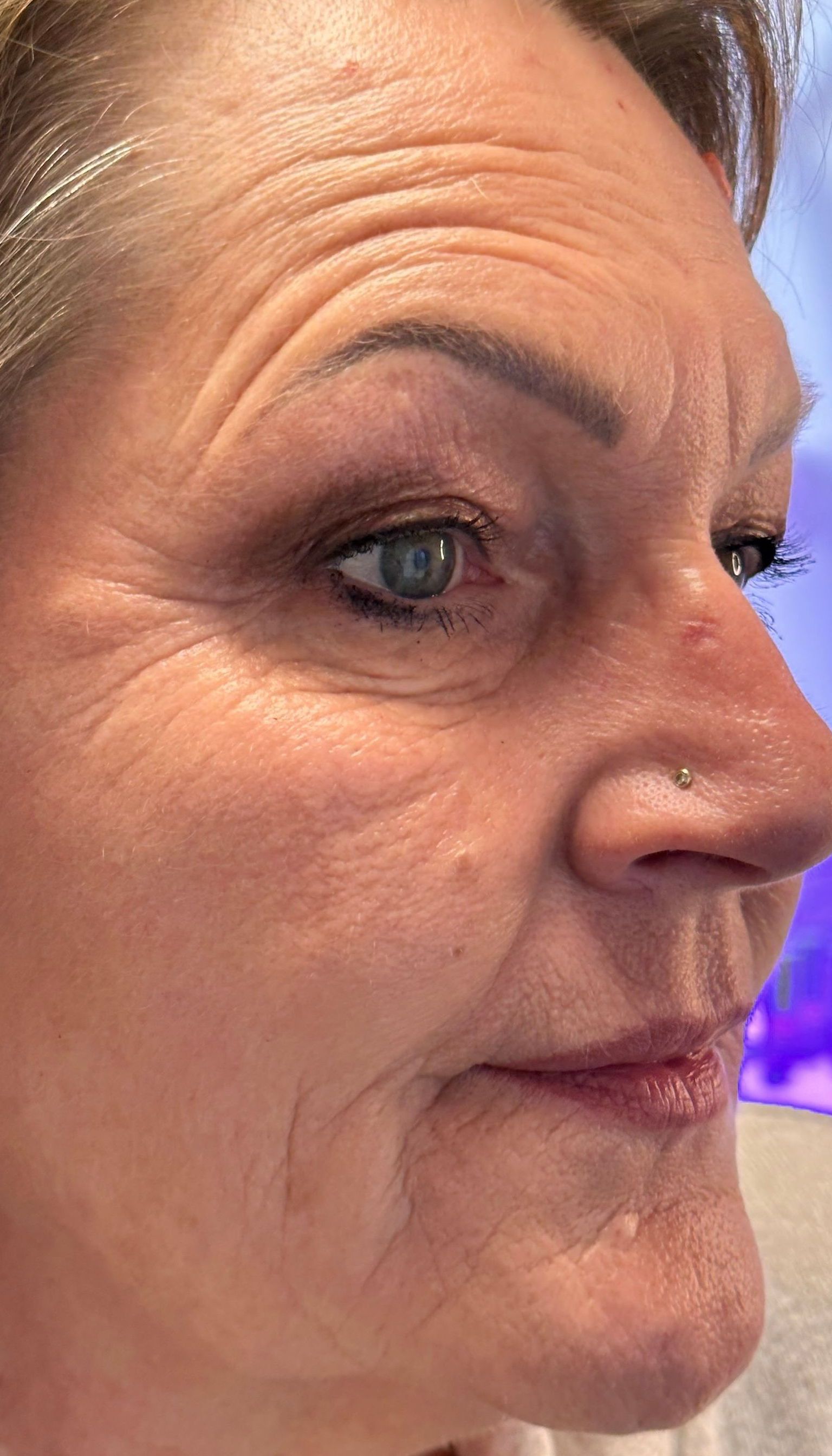 Fruchtsäurebehandlung, Fruchtsäure, PRX-T33, Anti Aging, glatte Haut, bbglow