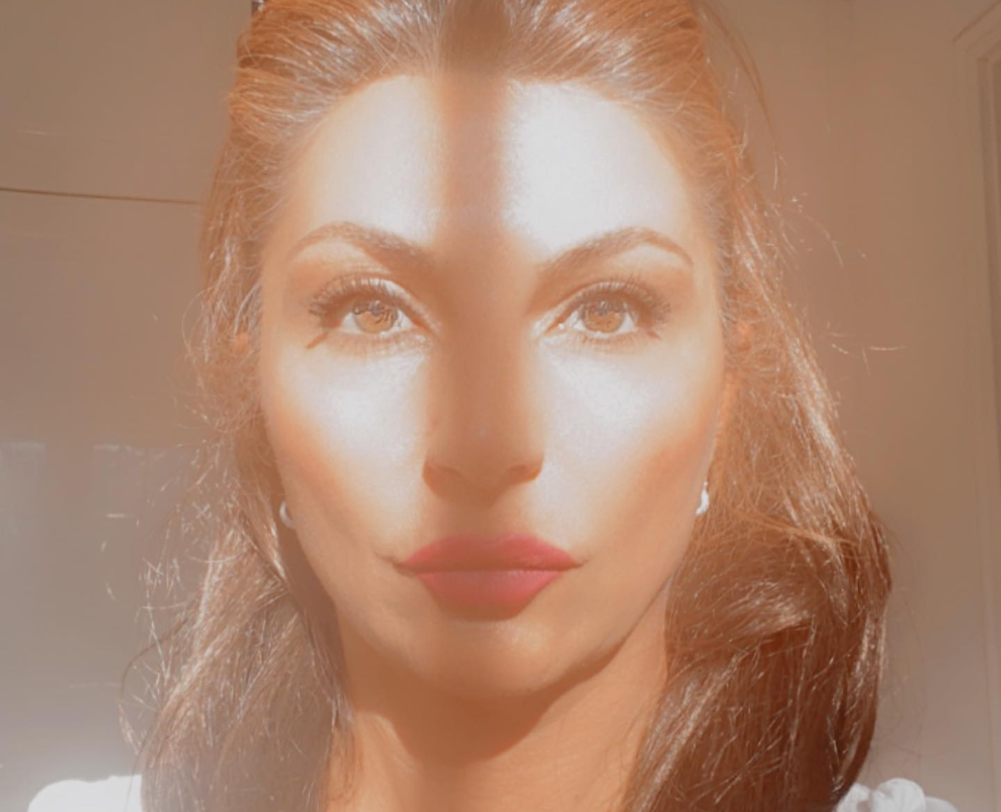 Ergebnis einer Plasma Pen Behandlung zur Oberlidstraffung – Straffung der Haut an den Oberlidern, Reduktion von Falten und ein frischer, jugendlicher Blick ohne Operation.