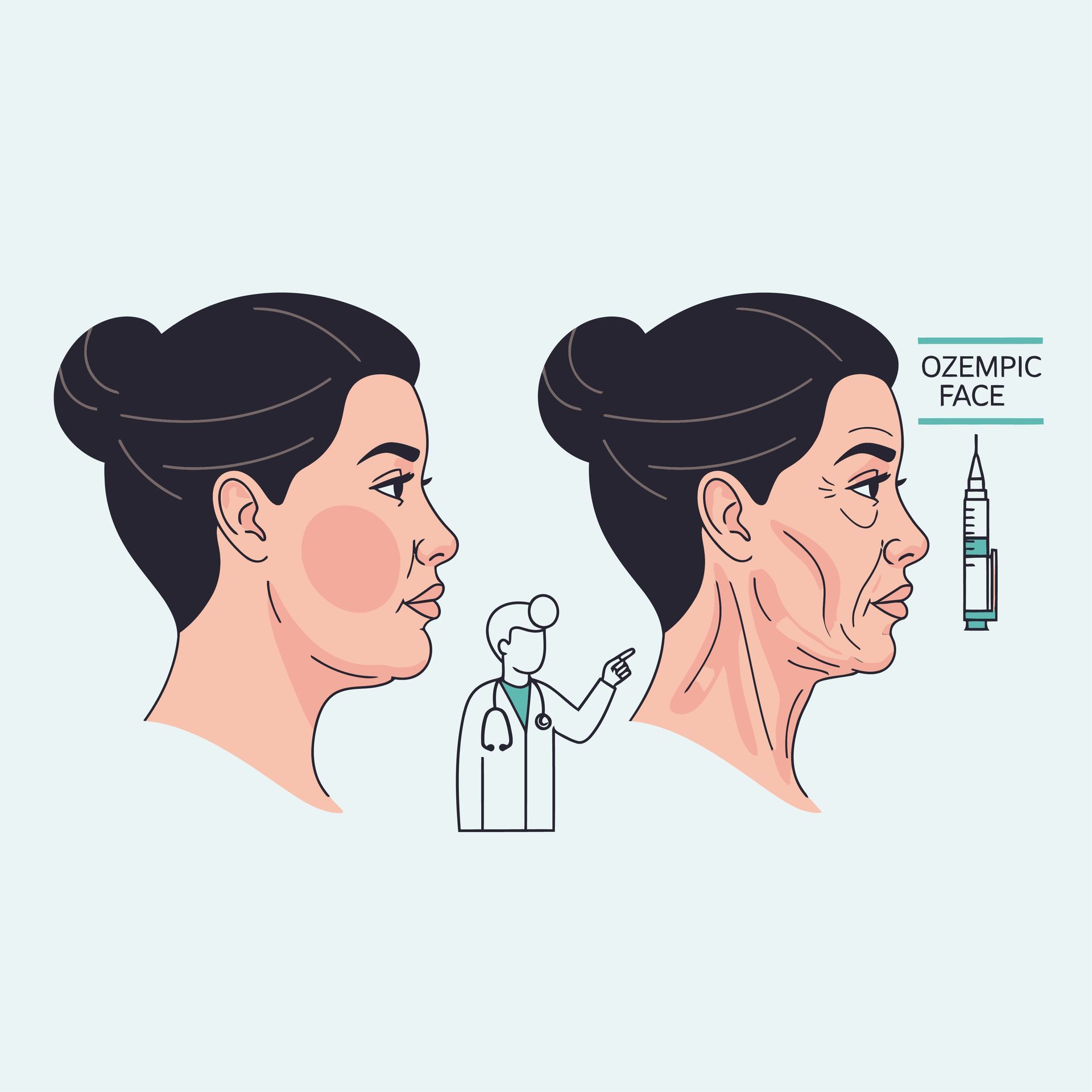 Ozempic Face – Gesicht nach schnellem Abnehmen