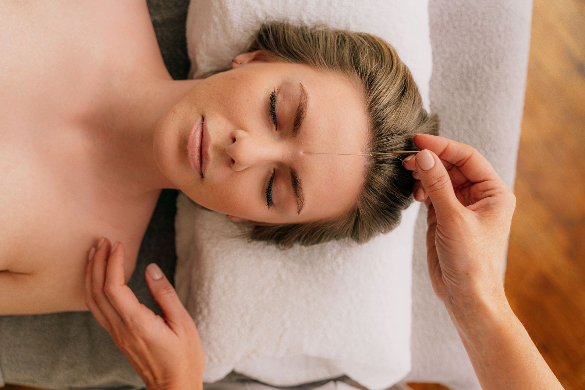 head and shoulders of a woman lying on a bed with eyes closed receiving acupuncture on her forehead