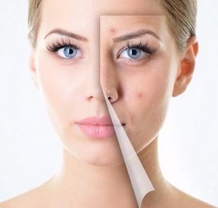 Cuidado de la piel grasa en verano