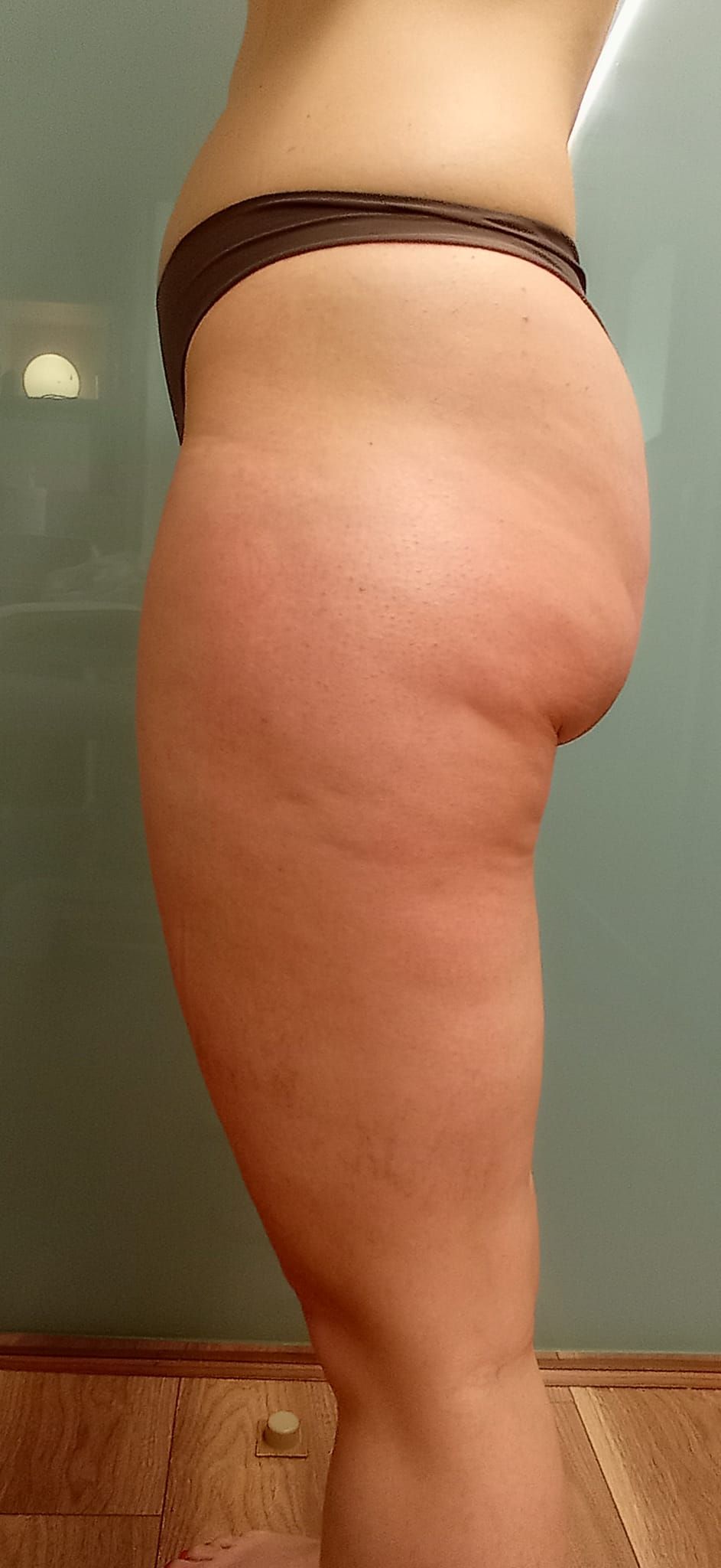 GLUTEOS