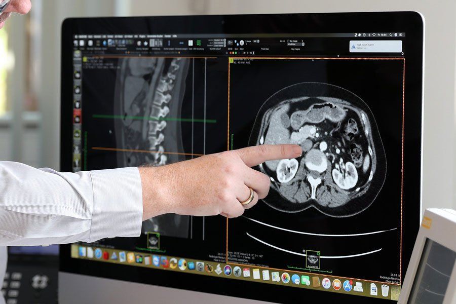 Arzt zeigt auf Schnittbilder von CT
