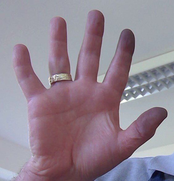 Kai´s Hand