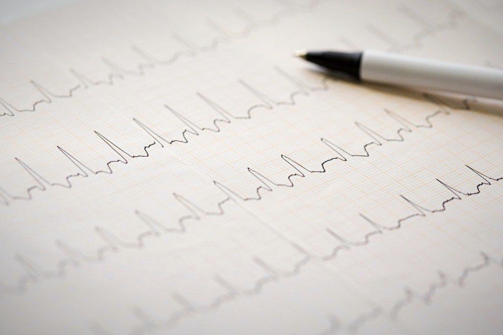 eine EEG-Aufzeichnung mit 5 Ableitungen ist zu sehen