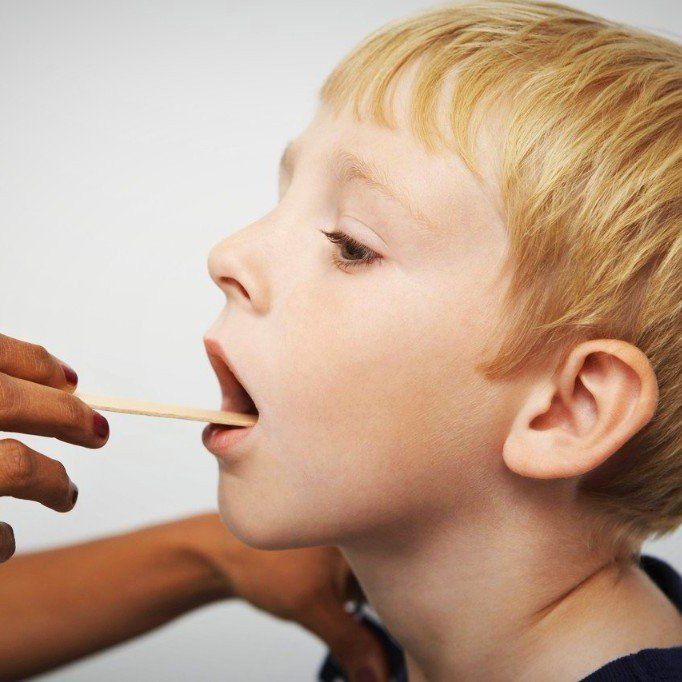 der Kopf eines Jungen mit geöffnetem Mund ist zu sehen, dessen Mund mit Hilfe eines Spatels untersucht wird