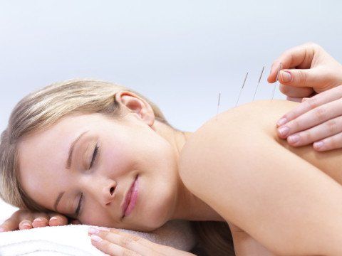 Acupuntura