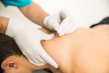 fisioterapia, teatinos, malaga, tratamientos, ondas de choque, epte, epi, calcificaciones, fascitis plantar, esguince, ecografía, punción seca