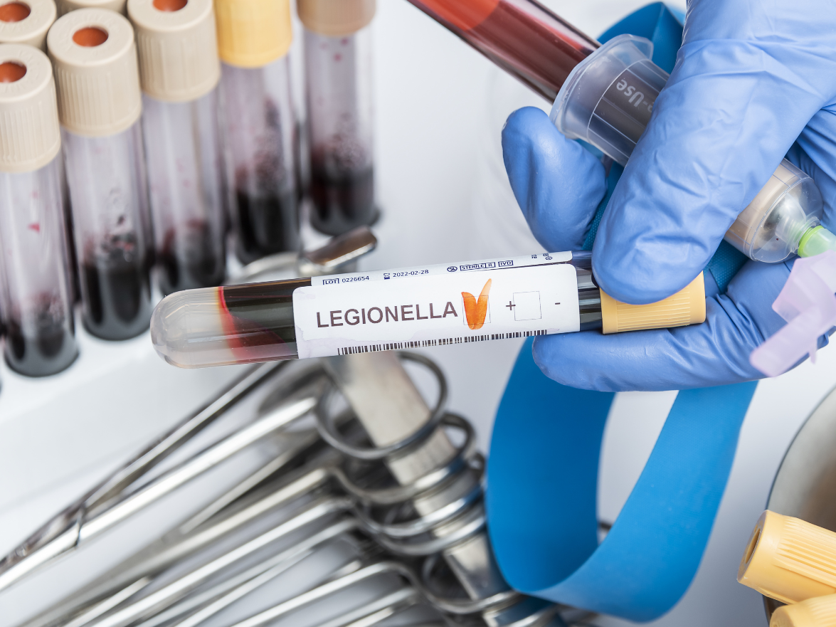 Legionella Control Torbay and South Devon