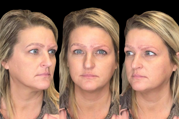 microblading nachteil