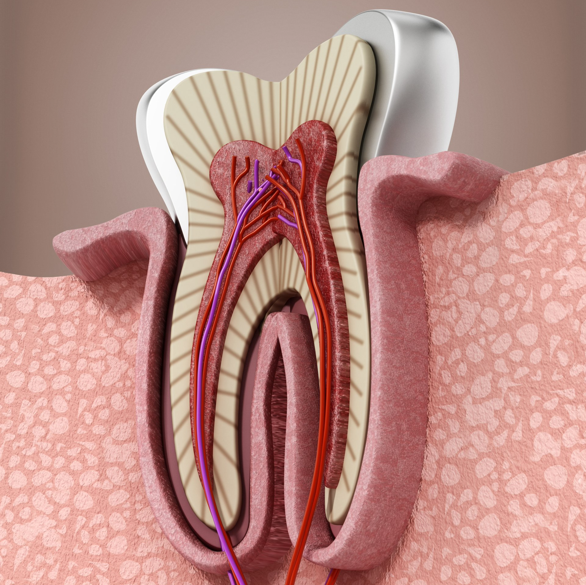 Wurzelspitzenresektion