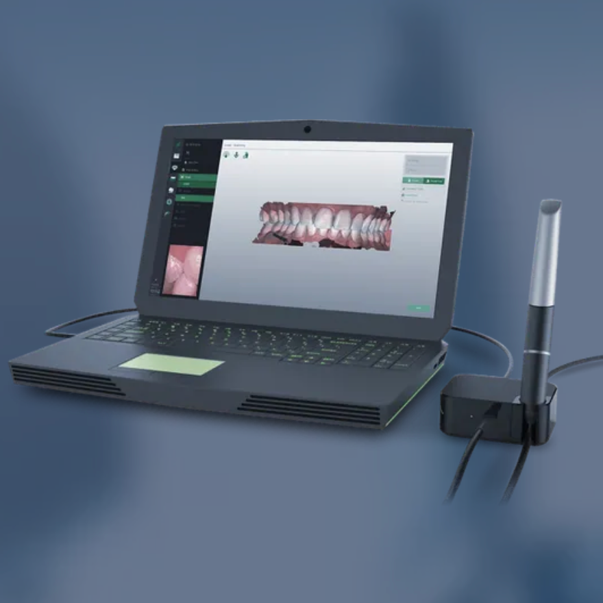 Digitale Abdrucknahme