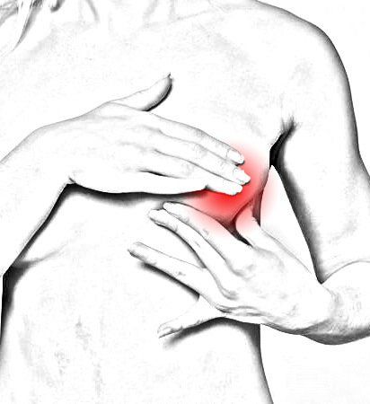 brulure sur le sein suite à une radiothérapie