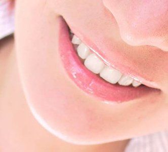 Mucites, chimio et radiothérapie