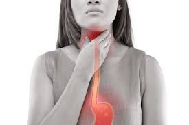conseils brûlured'estomac et reflux gastrique