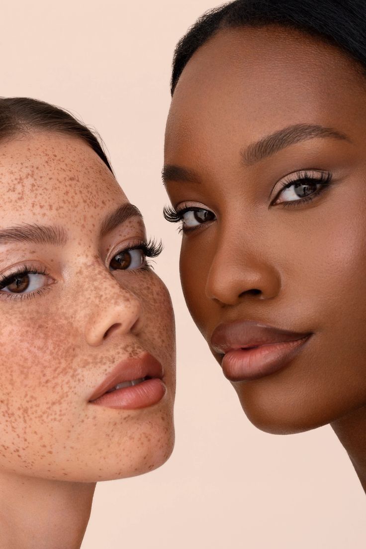 Faltenbehandlung in Berlin bei Wieners und Pantlen