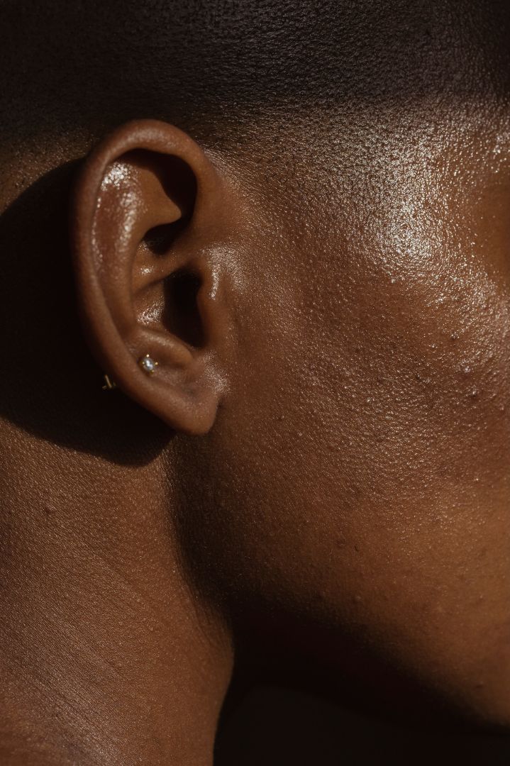 Korrektur bei abstehenden Ohren bei Wieners und Pantlen Berlin Ohrenkorrektur bei Wieners und Pantlen Berlin