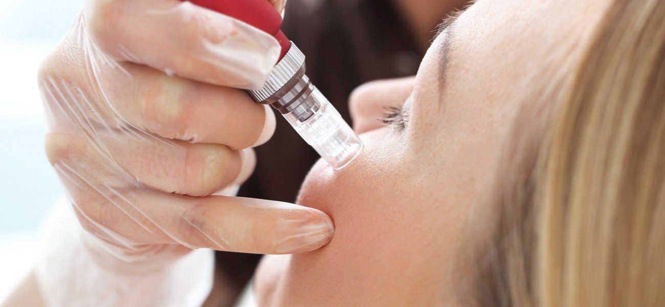 Medical Needling - Behandlung von Schwangerschaftsstreifen und Faltenreduktion bei Wieners und Pantlen Berlin Medical Needling - Faltenbehandlung und Reduktion von Schwangerschaftsstreifen bei Wieners und Pantlen Berlin