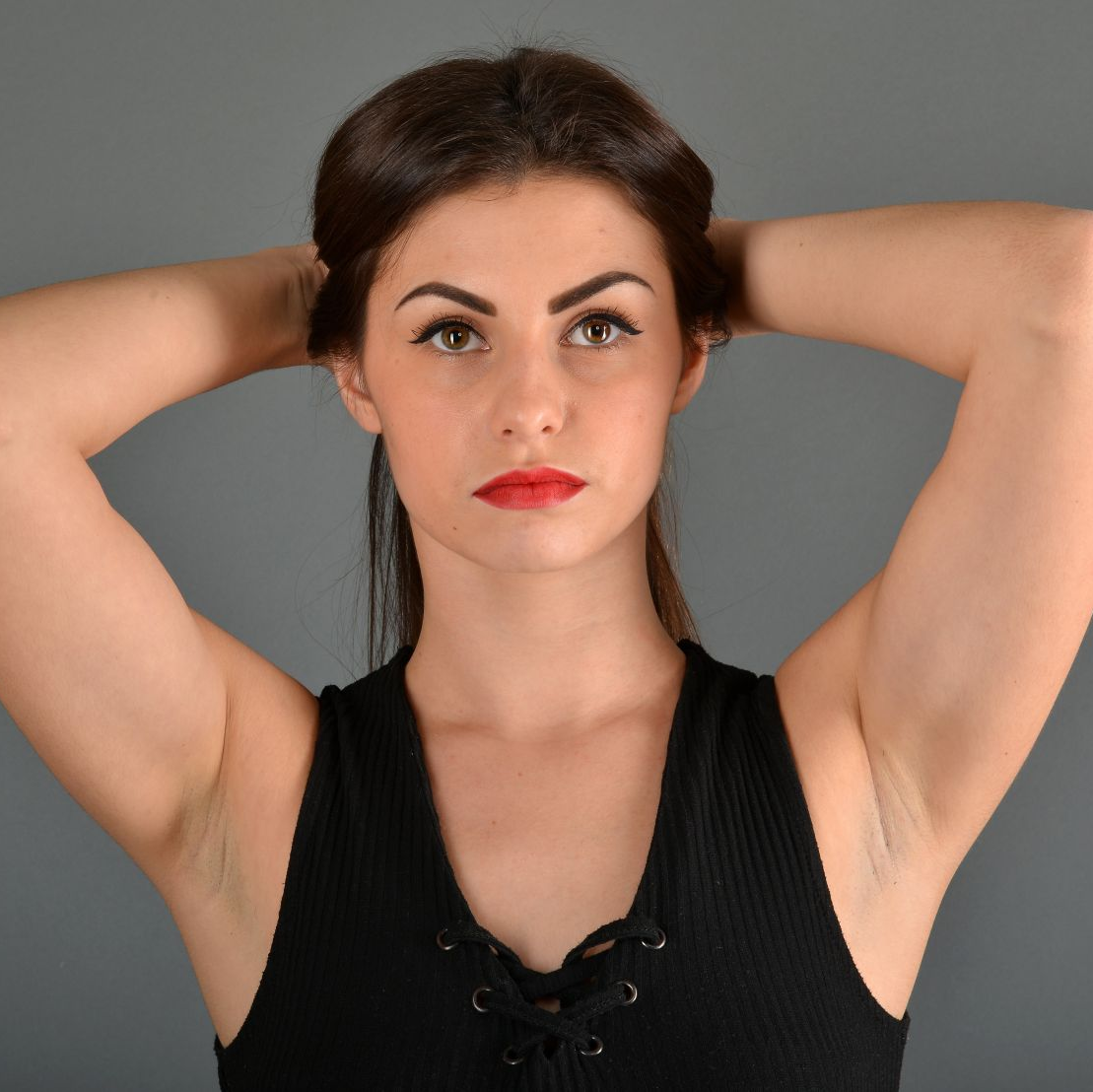 Schweissdrüsenentfernung in Berlin bei Wieners und Pantlen