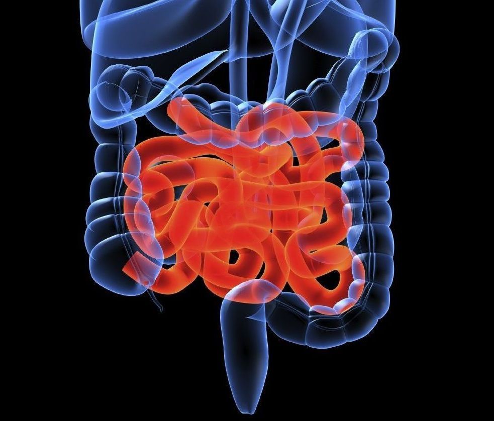 Darmgesundheit Augsburg, Darmtherapie in Augsburg, SIBO behandlung Augsburg, Darmflora-Test, Mikrobiomanalyse Augsburg