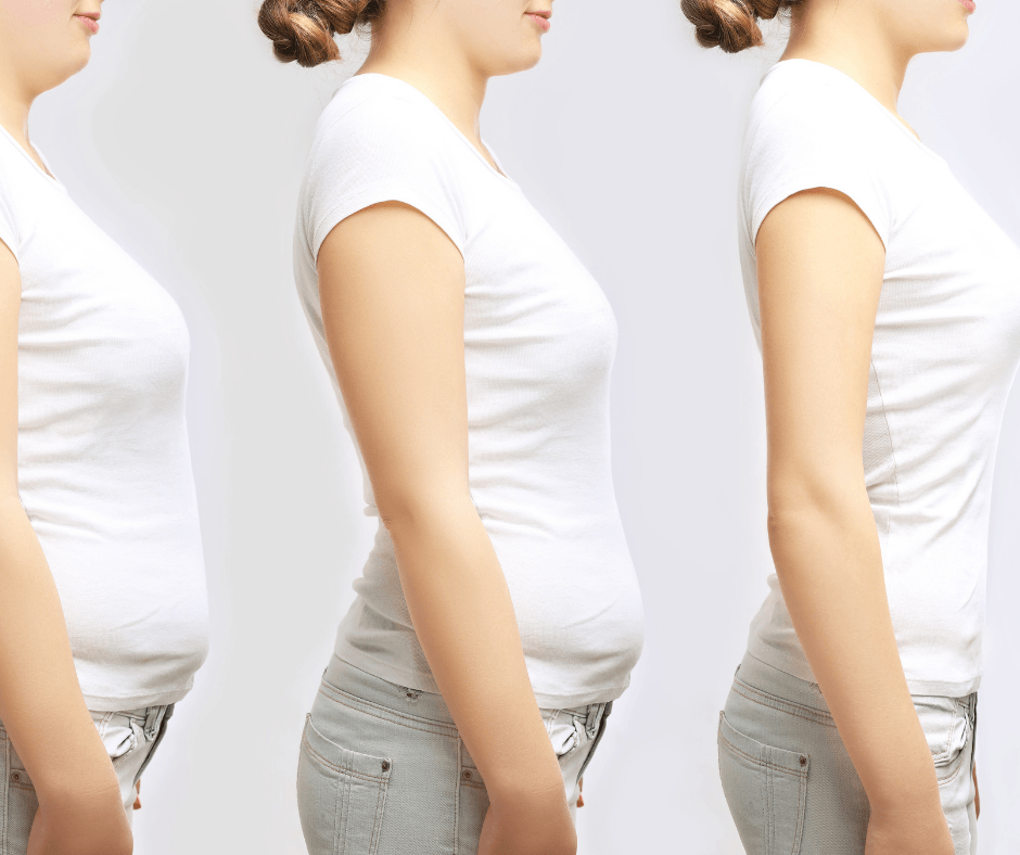 Hypnotherapy for Weight Management