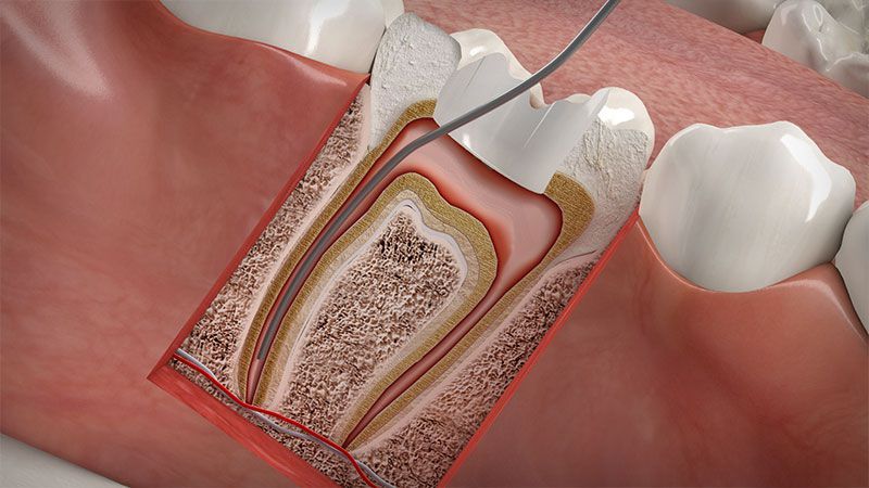 Endodontie