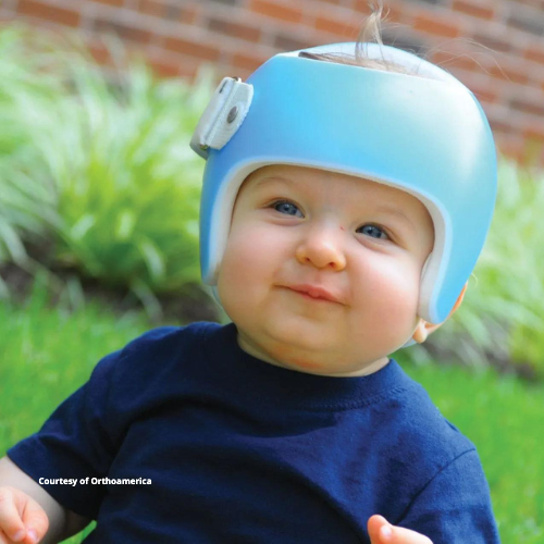 Courtesy of Orthoamerica