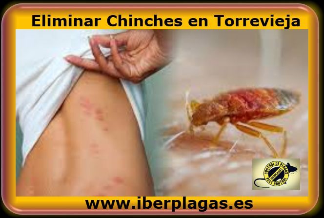 Eliminar chinches en Torrevieja