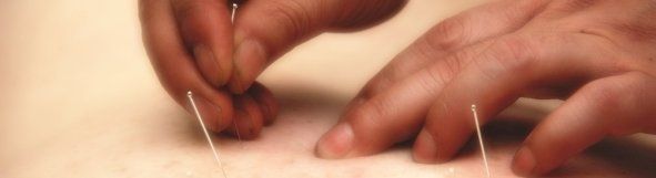 Acupuntura en las tendinopatías