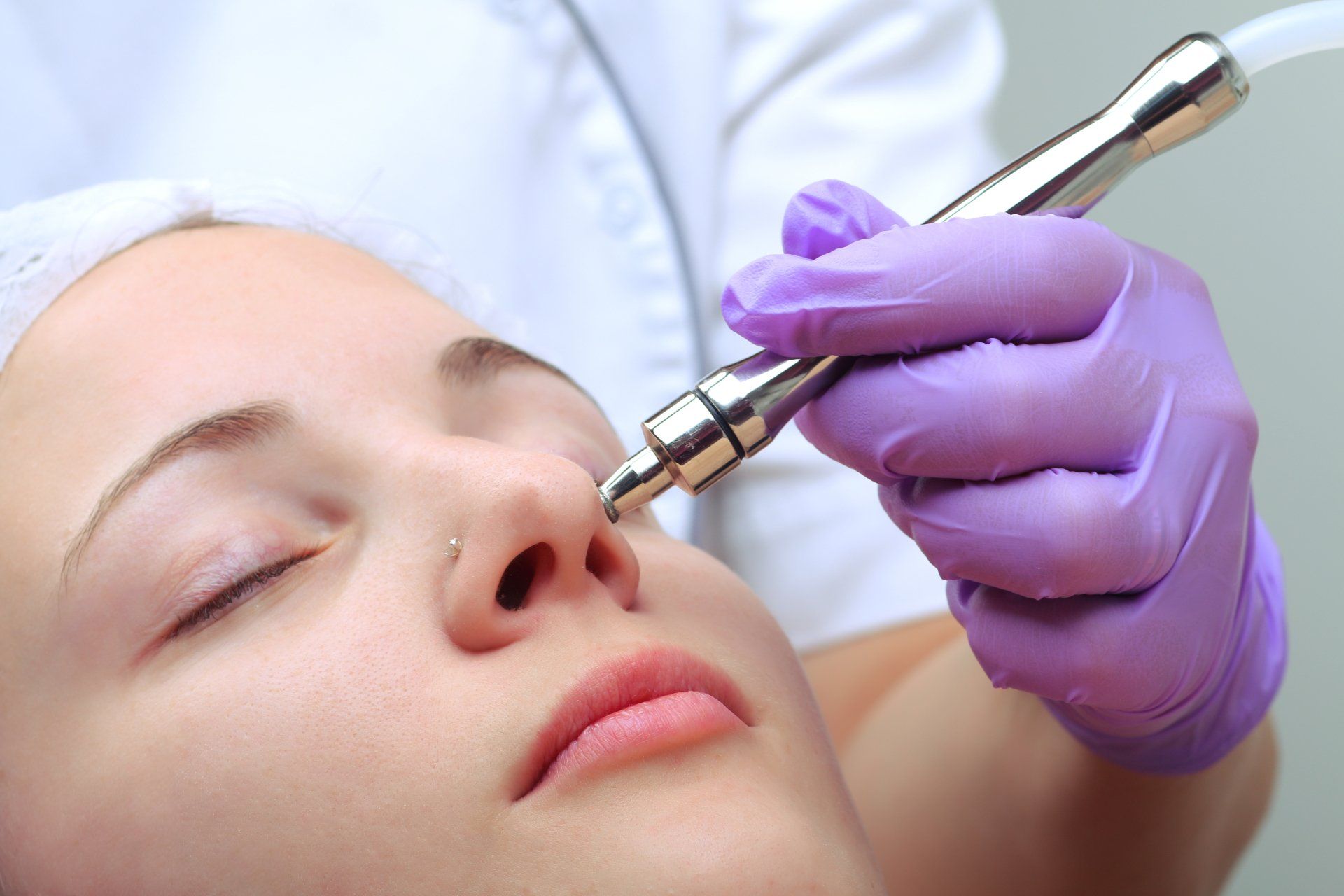 Microdermabrasion Microdermabrasion