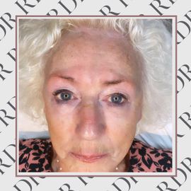 RDR Microblading Client Before Microblading