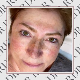 Microbladed Eyebrows, RDR Microblading, North Wales